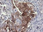 PIK3R5 Antibody in Immunohistochemistry (Paraffin) (IHC (P))