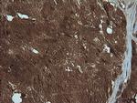 PIK3R5 Antibody in Immunohistochemistry (Paraffin) (IHC (P))