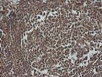 PIK3R5 Antibody in Immunohistochemistry (Paraffin) (IHC (P))
