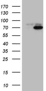 PIKFYVE Antibody in Western Blot (WB)
