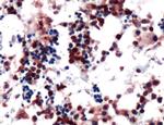 PIM1 Antibody in Immunohistochemistry (IHC)