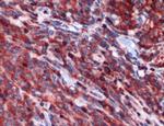 PIM2 Antibody in Immunohistochemistry (IHC)