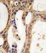 PIM1 Antibody in Immunohistochemistry (IHC)