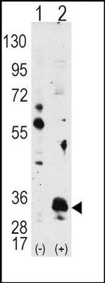 PIM1 Antibody in Western Blot (WB)