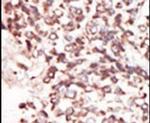 PIM2 Antibody in Immunohistochemistry (IHC)