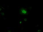 PIM2 Antibody in Immunocytochemistry (ICC/IF)
