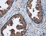 PIM2 Antibody in Immunohistochemistry (Paraffin) (IHC (P))