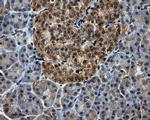 PIM2 Antibody in Immunohistochemistry (Paraffin) (IHC (P))