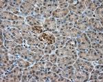 PIM2 Antibody in Immunohistochemistry (Paraffin) (IHC (P))