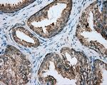 PIM2 Antibody in Immunohistochemistry (Paraffin) (IHC (P))