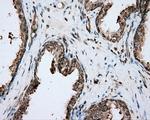 PIM2 Antibody in Immunohistochemistry (Paraffin) (IHC (P))