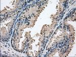 PIM2 Antibody in Immunohistochemistry (Paraffin) (IHC (P))