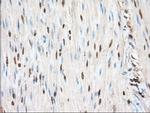PIM2 Antibody in Immunohistochemistry (Paraffin) (IHC (P))