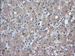 PIM2 Antibody in Immunohistochemistry (Paraffin) (IHC (P))