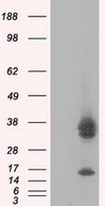 PIM2 Antibody in Western Blot (WB)