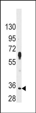 PIM2 Antibody in Western Blot (WB)