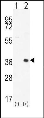 PIM2 Antibody in Western Blot (WB)