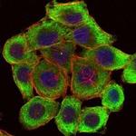 LIMS1 Monoclonal Antibody (5G7)