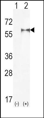 PIP5K1A Antibody in Western Blot (WB)