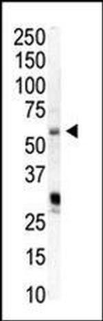 PIP5K1A Antibody in Western Blot (WB)