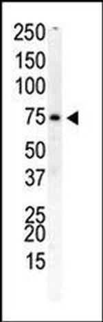 PIP5K1B Antibody in Western Blot (WB)