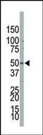PIP4K2B Antibody in Western Blot (WB)