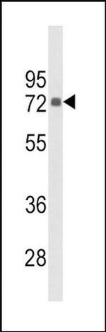 PIP5K1C Antibody in Western Blot (WB)