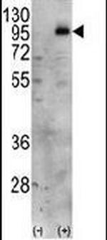 PIP5K1C Antibody in Western Blot (WB)