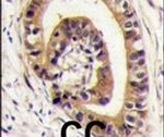 PIST Antibody in Immunohistochemistry (IHC)