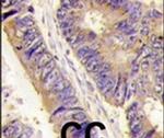PIST Antibody in Immunohistochemistry (IHC)