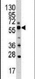 PIST Antibody in Western Blot (WB)