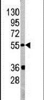 PIST Antibody in Western Blot (WB)