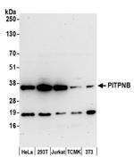 PITPNB Polyclonal Antibody