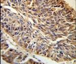 PITX1 Antibody in Immunohistochemistry (IHC)