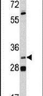PITX1 Antibody in Western Blot (WB)