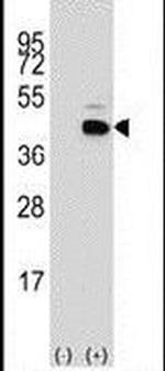 PITX1 Antibody in Western Blot (WB)