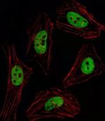 PITX2 Antibody in Immunocytochemistry (ICC/IF)