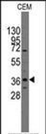 PITX2 Antibody in Western Blot (WB)