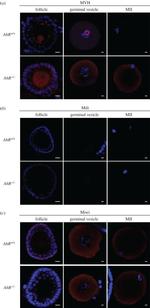 PIWIL1 Antibody in Immunohistochemistry (IHC)