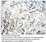 Phospho-JAK1 (Tyr1034, Tyr1035) Polyclonal Antibody