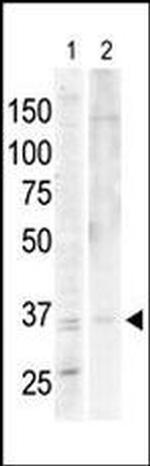 PKA alpha/beta Antibody in Western Blot (WB)
