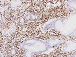 PRKAR1A Antibody in Immunohistochemistry (IHC)