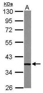 PRKAR1A Antibody in Western Blot (WB)
