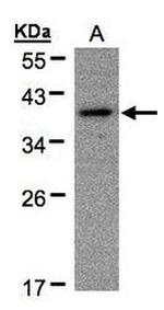 PRKAR1A Antibody in Western Blot (WB)