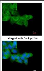 PRKAR1A Antibody in Immunocytochemistry (ICC/IF)