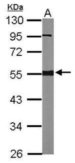 PRKAR1A Antibody in Western Blot (WB)