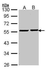 PRKAR1A Antibody in Western Blot (WB)
