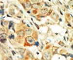 PKC alpha Antibody in Immunohistochemistry (IHC)