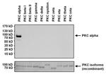PKC alpha Antibody in Western Blot (WB)