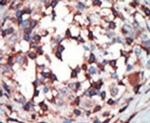 PKC beta Antibody in Immunohistochemistry (IHC)